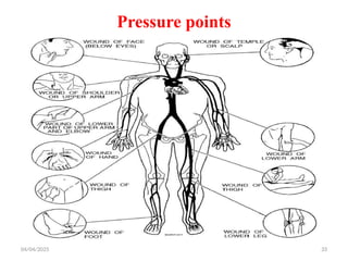 04/04/2025 33
Pressure points
 