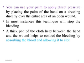 04/04/2025 37
• You can use your palm to apply direct pressure
by placing the palm of the hand on a dressing
directly over the entire area of an open wound.
• In most instances this technique will stop the
bleeding
• A thick pad of the cloth held between the hand
and the wound helps to control the bleeding by
absorbing the blood and allowing it to clot
 