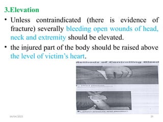04/04/2025 39
3.Elevation
• Unless contraindicated (there is evidence of
fracture) severally bleeding open wounds of head,
neck and extremity should be elevated.
• the injured part of the body should be raised above
the level of victim’s heart.
 