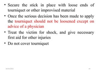 04/04/2025 49
• Secure the stick in place with loose ends of
tourniquet or other improvised material
• Once the serious decision has been made to apply
the tourniquet should not be loosened except on
advice of a physician
• Treat the victim for shock, and give necessary
first aid for other injuries
• Do not cover tourniquet
 