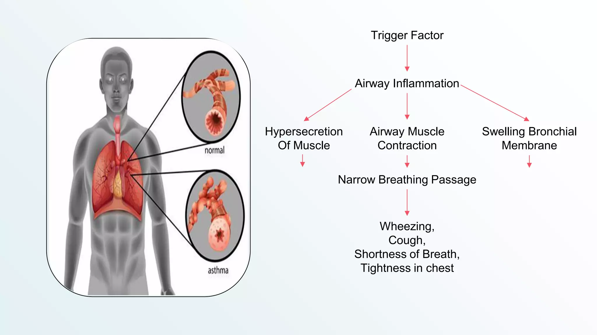 Pharmacotherapeutics-Asthma | PDF