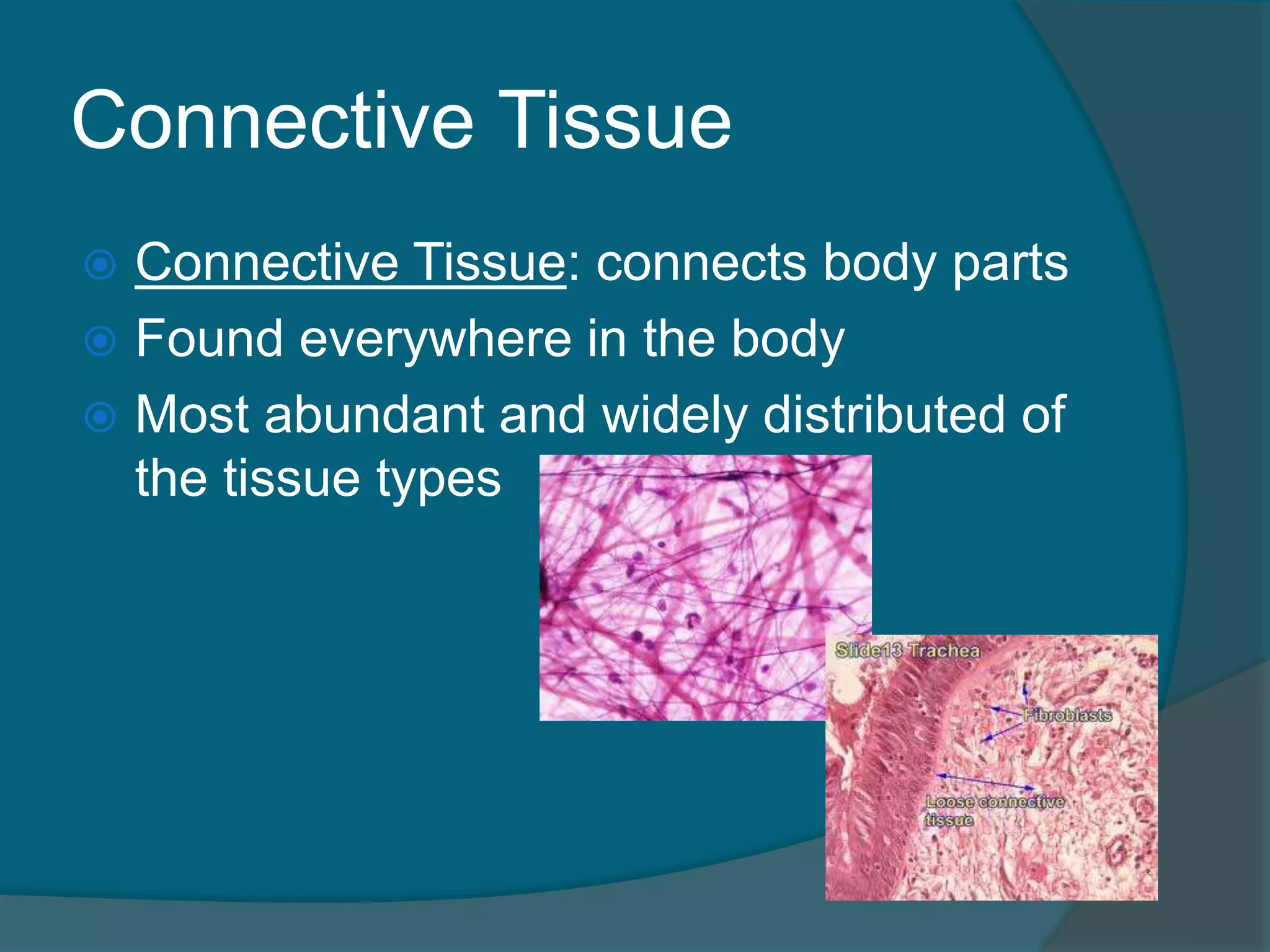 Connective Tissue
 Connective Tissue: connects body parts
 Found everywhere in the body
 Most abundant and widely distributed of
the tissue types
 
