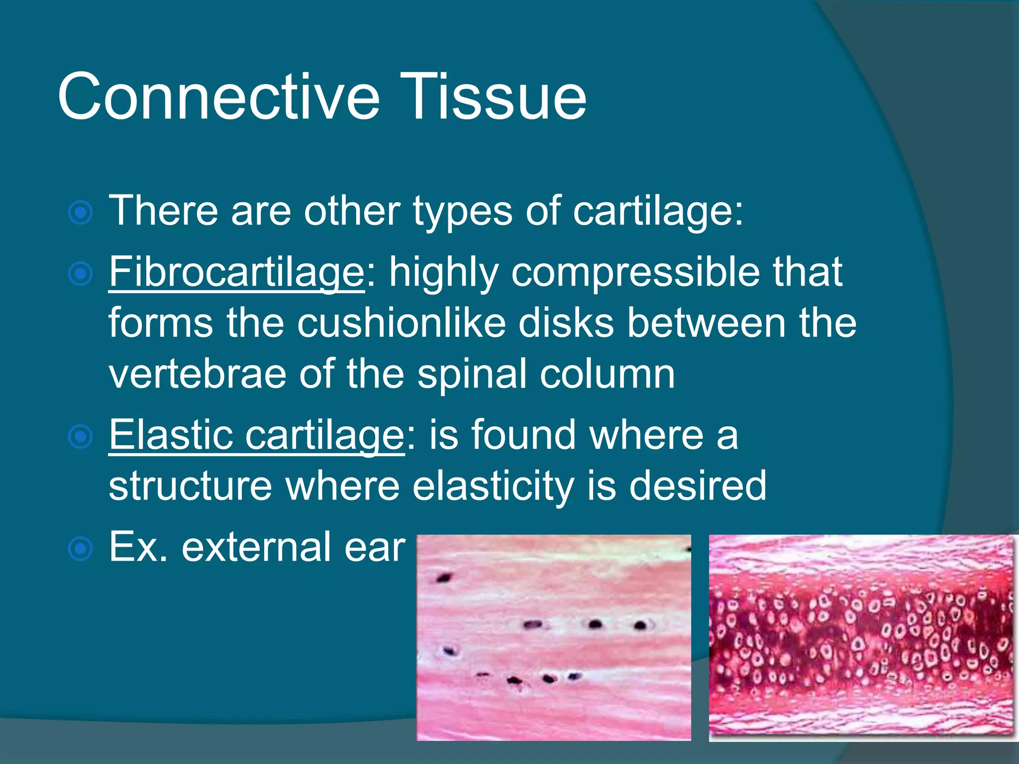 Connective Tissue
 There are other types of cartilage:
 Fibrocartilage: highly compressible that
forms the cushionlike disks between the
vertebrae of the spinal column
 Elastic cartilage: is found where a
structure where elasticity is desired
 Ex. external ear
 