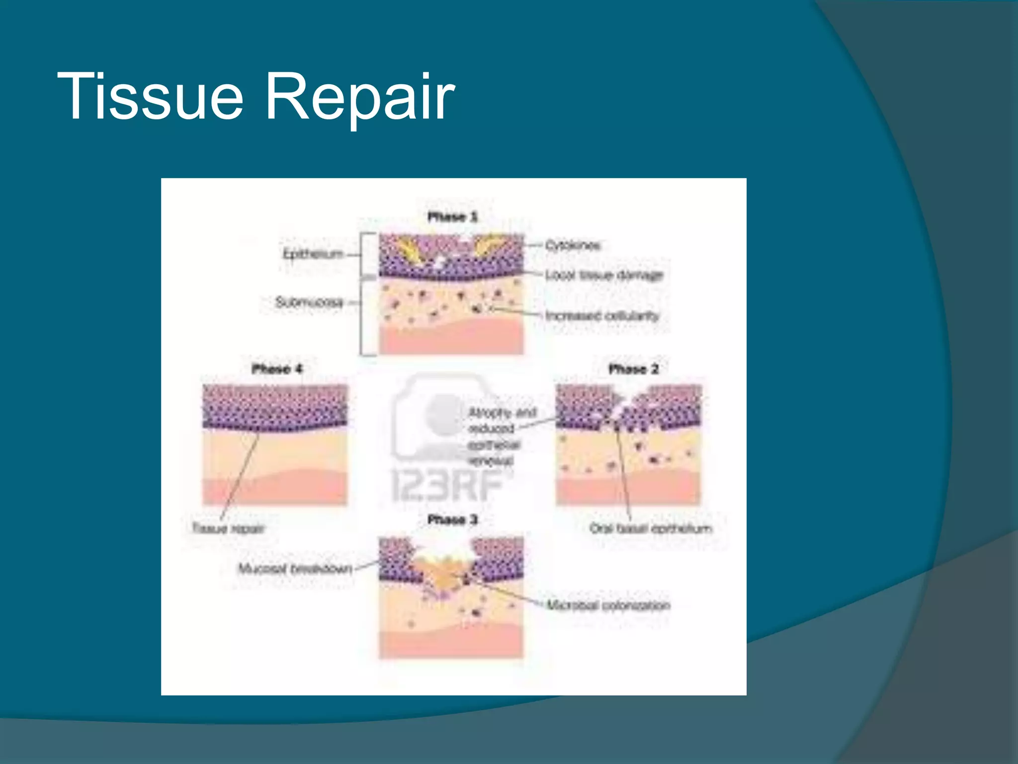 Tissue Repair
 