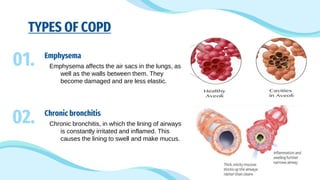COPD-Chronic Obstructive Pulmonary Disease | PDF