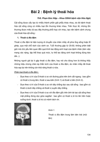 Bài 2 : Bệnh lý thoái hóa
ThS. Phạm Đức Hiệp – Khoa CĐHA bệnh viện Hữu Nghị
Cột sống được cấu tạo từ nhiều thành phần giải phẫu khác nhau, do đó bệnh thoái
hóa cột sống cũng có nhiều loại tổn thương khác nhau. Trên thực tế, những tổn
thương được miêu tả sau đây thường phối hợp với nhau, tạo nên bệnh cảnh chung
của thoái hóa cột sống :
1. Thoát vị đĩa đệm
Thoát vị đĩa đệm là hiện tượng di chuyển của nhân nhầy về phía ống sống hoặc lỗ
ghép, qua một chỗ rách của vành xơ. Tuổi thường gặp từ 25-50, không phân biệt
giới mà chủ yếu liên quan đến quá trình lao động sinh hoạt của bệnh nhân (làm việc
mang vác nặng, tập thể thao quá mức, tư thế lao động sinh hoạt không đúng kéo
dài...).
Những người già lại ít gặp thoát vị đĩa đệm, hay nói cho đúng hơn là không thấy
những triệu chứng chèn ép thần kinh của thoát vị đĩa đệm, do nhân nhầy đã thoái
hóa xẹp lại nên không còn khả năng thoát vị nữa.
Phân loại thoát vị đĩa đệm :
-

Dựa theo vị trí của ổ thoát vị so với đường giữa trên ảnh cắt ngang : bao gồm
có thoát vị trung tâm, thoát vị sau-bên (hình 1) và thoát vị bên (hình 2).

-

Dựa theo vị trí của ổ thoát vị so với dây chằng dọc sau cột sống : bao gồm có
thoát vị dưới dây chằng và thoát vị xuyên dây chằng.

-

Dựa theo vị trí của ổ thoát vị so với đĩa đệm gốc trên ảnh tái tạo cột sống theo
mặt phẳng đứng dọc giữa sagittal : bao gồm có thoát vị di trú lên trên hoặc
xuống dưới, thoát vị di trú có mảnh tách rời.

Hình 1
Thoát vị đĩa đệm trung tâm bên trái (mũi
tên)

134

 