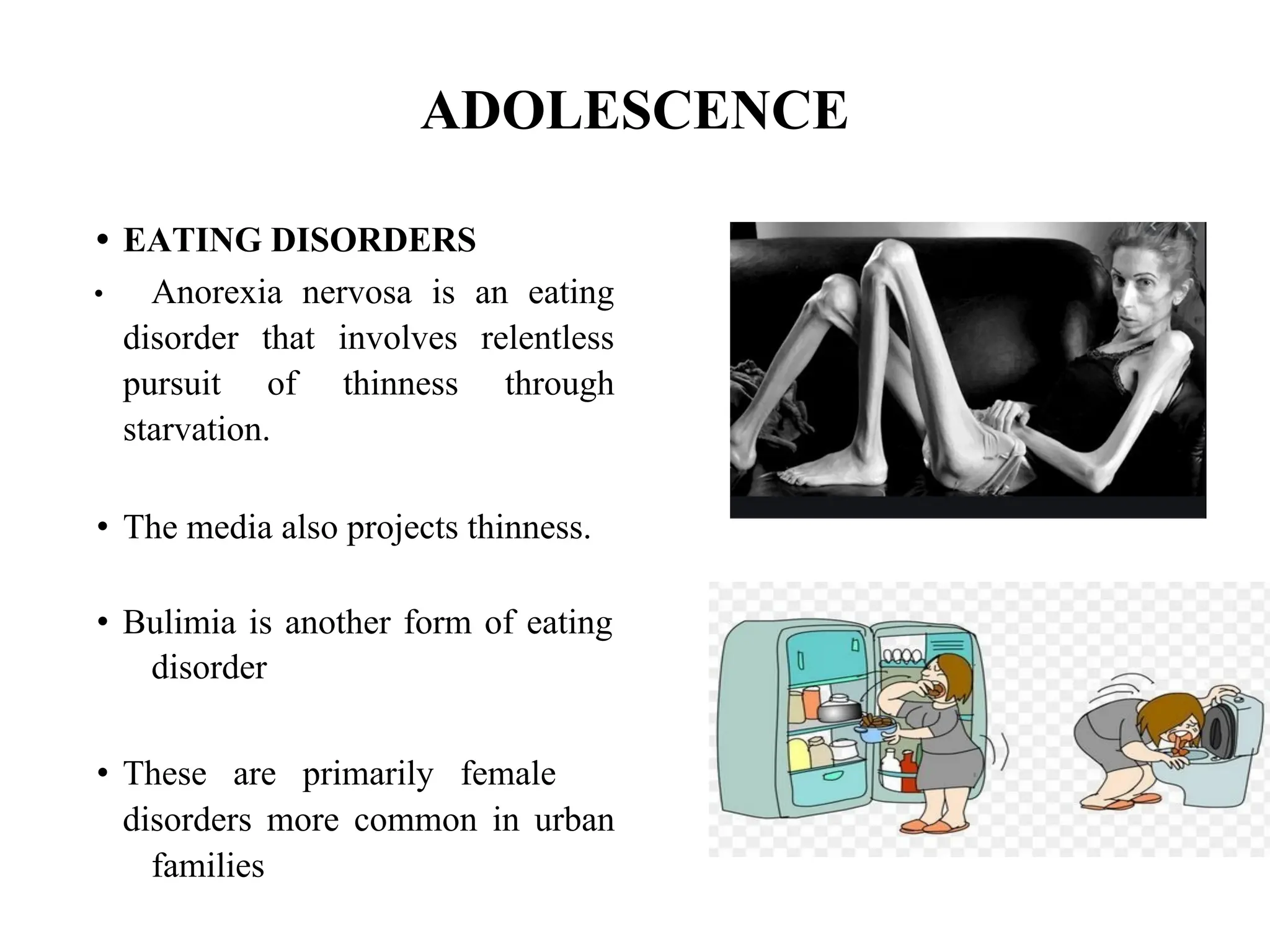 ADOLESCENCE
• EATING DISORDERS
• Anorexia nervosa is an eating
disorder that involves relentless
pursuit of thinness through
starvation.
• The media also projects thinness.
• Bulimia is another form of eating
disorder
• These are primarily female
disorders more common in urban
families
 