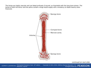 Prehospital Emergency Care, 10th
edition
Mistovich | Karren
Copyright © 2014, 2010, 2008 by Pearson Education, Inc.
All Rights Reserved
The bones are highly vascular and can bleed profusely if injured, as illustrated with the long bone shown. The
bones of both the femur and the pelvis contain a large blood supply with a tendency to bleed heavily when
fractured.
continued on next slide
 