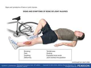 Prehospital Emergency Care, 10th
edition
Mistovich | Karren
Copyright © 2014, 2010, 2008 by Pearson Education, Inc.
All Rights Reserved
Signs and symptoms of bone or joint injuries.
continued on next slide
 
