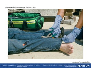 Prehospital Emergency Care, 10th
edition
Mistovich | Karren
Copyright © 2014, 2010, 2008 by Pearson Education, Inc.
All Rights Reserved
Cut away clothing to expose the injury site.
continued on next slide
 