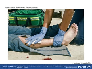 Prehospital Emergency Care, 10th
edition
Mistovich | Karren
Copyright © 2014, 2010, 2008 by Pearson Education, Inc.
All Rights Reserved
Place a sterile dressing over the open wound.
continued on next slide
 