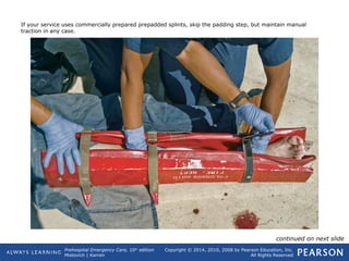 Prehospital Emergency Care, 10th
edition
Mistovich | Karren
Copyright © 2014, 2010, 2008 by Pearson Education, Inc.
All Rights Reserved
If your service uses commercially prepared prepadded splints, skip the padding step, but maintain manual
traction in any case.
continued on next slide
 