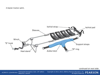 Prehospital Emergency Care, 10th
edition
Mistovich | Karren
Copyright © 2014, 2010, 2008 by Pearson Education, Inc.
All Rights Reserved
A bipolar traction splint.
continued on next slide
 