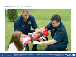 Prehospital Emergency Care, 10th
edition
Mistovich | Karren
Copyright © 2014, 2010, 2008 by Pearson Education, Inc.
All Rights Reserved
Apply the splint and secure it to the extremity.
 