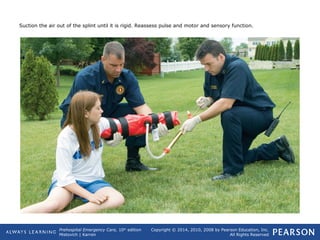 Prehospital Emergency Care, 10th
edition
Mistovich | Karren
Copyright © 2014, 2010, 2008 by Pearson Education, Inc.
All Rights Reserved
Suction the air out of the splint until it is rigid. Reassess pulse and motor and sensory function.
 