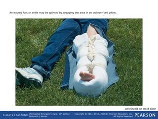 Prehospital Emergency Care, 10th
edition
Mistovich | Karren
Copyright © 2014, 2010, 2008 by Pearson Education, Inc.
All Rights Reserved
An injured foot or ankle may be splinted by wrapping the area in an ordinary bed pillow.
continued on next slide
 