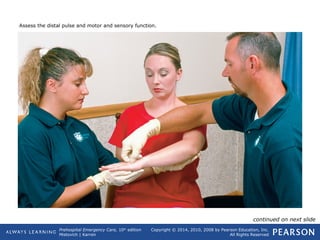 Prehospital Emergency Care, 10th
edition
Mistovich | Karren
Copyright © 2014, 2010, 2008 by Pearson Education, Inc.
All Rights Reserved
Assess the distal pulse and motor and sensory function.
continued on next slide
 