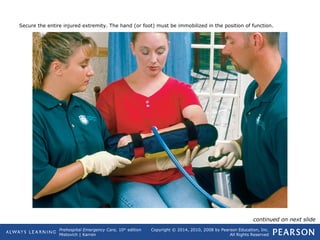 Prehospital Emergency Care, 10th
edition
Mistovich | Karren
Copyright © 2014, 2010, 2008 by Pearson Education, Inc.
All Rights Reserved
Secure the entire injured extremity. The hand (or foot) must be immobilized in the position of function.
continued on next slide
 