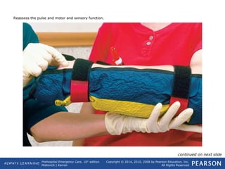 Prehospital Emergency Care, 10th
edition
Mistovich | Karren
Copyright © 2014, 2010, 2008 by Pearson Education, Inc.
All Rights Reserved
Reassess the pulse and motor and sensory function.
continued on next slide
 