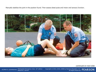 Prehospital Emergency Care, 10th
edition
Mistovich | Karren
Copyright © 2014, 2010, 2008 by Pearson Education, Inc.
All Rights Reserved
Manually stabilize the joint in the position found. Then assess distal pulse and motor and sensory function.
continued on next slide
 