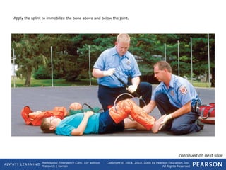 Prehospital Emergency Care, 10th
edition
Mistovich | Karren
Copyright © 2014, 2010, 2008 by Pearson Education, Inc.
All Rights Reserved
Apply the splint to immobilize the bone above and below the joint.
continued on next slide
 