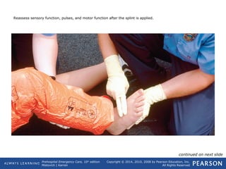 Prehospital Emergency Care, 10th
edition
Mistovich | Karren
Copyright © 2014, 2010, 2008 by Pearson Education, Inc.
All Rights Reserved
Reassess sensory function, pulses, and motor function after the splint is applied.
continued on next slide
 