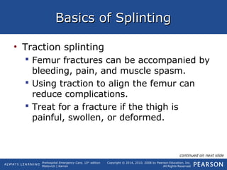 Prehospital Emergency Care, 10th
edition
Mistovich | Karren
Copyright © 2014, 2010, 2008 by Pearson Education, Inc.
All Rights Reserved
Basics of SplintingBasics of Splinting
• Traction splinting
 Femur fractures can be accompanied by
bleeding, pain, and muscle spasm.
 Using traction to align the femur can
reduce complications.
 Treat for a fracture if the thigh is
painful, swollen, or deformed.
continued on next slide
 
