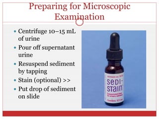 Preparing for Microscopic
Examination
 Centrifuge 10–15 mL
of urine
 Pour off supernatant
urine
 Resuspend sediment
by tapping
 Stain (optional) >>
 Put drop of sediment
on slide
 