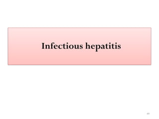 49
Infectious hepatitis
 