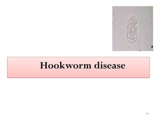 89
Hookworm disease
 