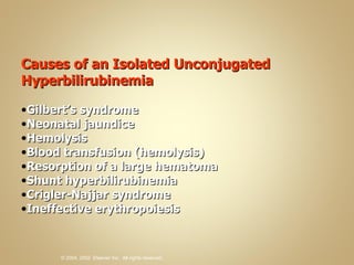 Causes of an Isolated Unconjugated Hyperbilirubinemia Gilbert’s syndrome Neonatal jaundice Hemolysis Blood transfusion (hemolysis) Resorption of a large hematoma Shunt hyperbilirubinemia Crigler-Najjar syndrome Ineffective erythropoiesis 