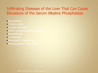 Infiltrating Diseases of the Liver That Can Cause Elevations of the Serum Alkaline Phosphatase Sarcoidosis Tuberculosis Fungal infection Other granulomatous diseases Amyloidosis Lymphoma Metastatic malignancy Hepatocellular carcinoma 