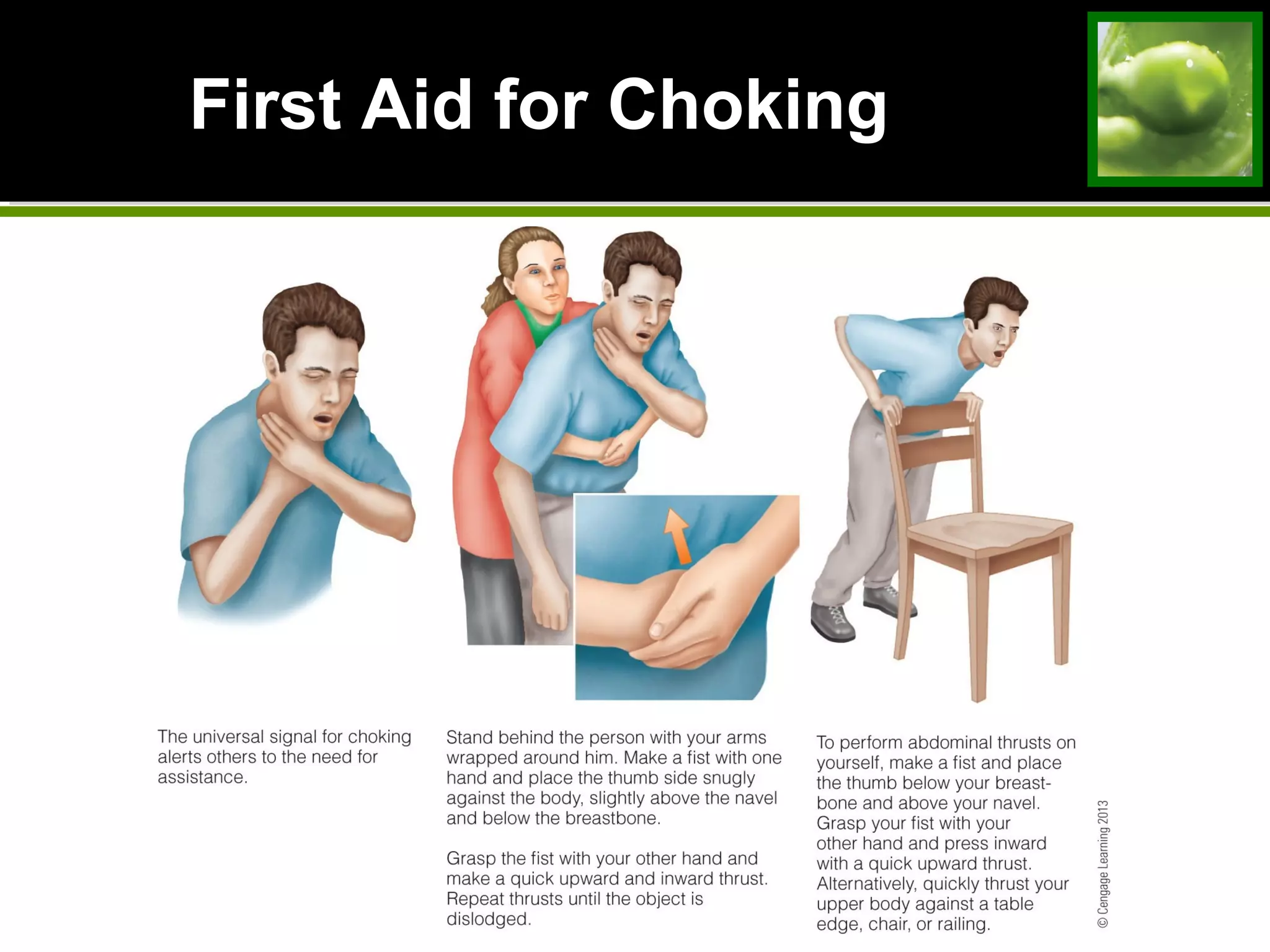First Aid for ChokingFirst Aid for Choking
 