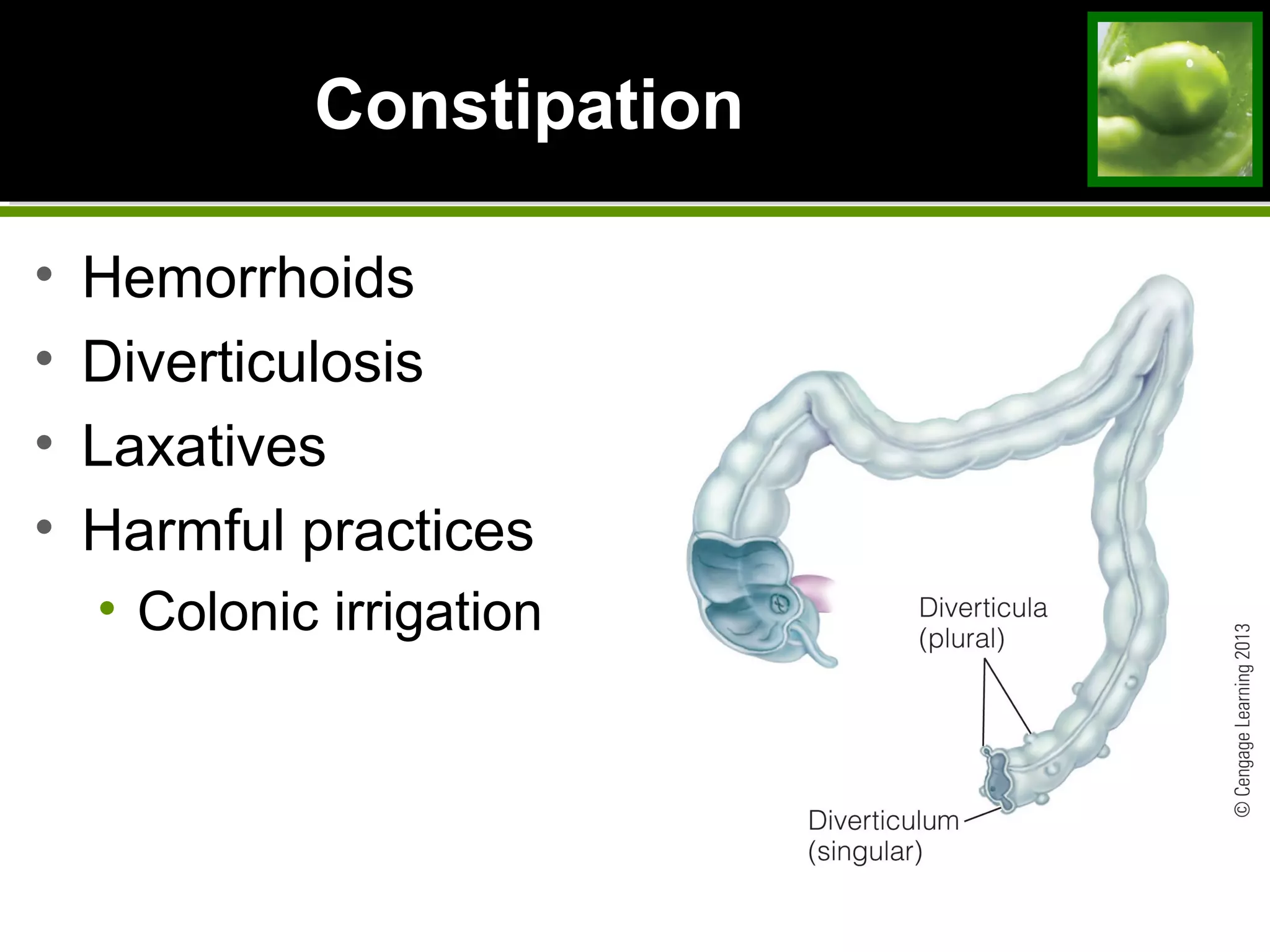 Constipation
• Hemorrhoids
• Diverticulosis
• Laxatives
• Harmful practices
• Colonic irrigation
 