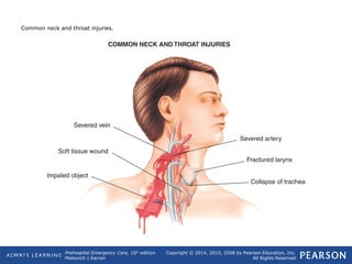 Prehospital Emergency Care, 10th
edition
Mistovich | Karren
Copyright © 2014, 2010, 2008 by Pearson Education, Inc.
All Rights Reserved
Common neck and throat injuries.
 