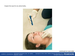 Prehospital Emergency Care, 10th
edition
Mistovich | Karren
Copyright © 2014, 2010, 2008 by Pearson Education, Inc.
All Rights Reserved
Inspect the eyes for any abnormality.
continued on next slide
 