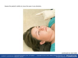 Prehospital Emergency Care, 10th
edition
Mistovich | Karren
Copyright © 2014, 2010, 2008 by Pearson Education, Inc.
All Rights Reserved
Assess the patient’s ability to move the eyes in any direction.
continued on next slide
 