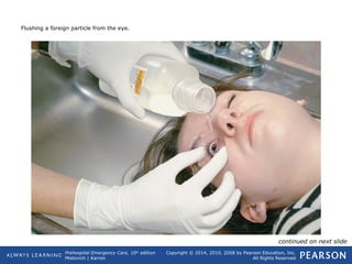 Prehospital Emergency Care, 10th
edition
Mistovich | Karren
Copyright © 2014, 2010, 2008 by Pearson Education, Inc.
All Rights Reserved
Flushing a foreign particle from the eye.
continued on next slide
 