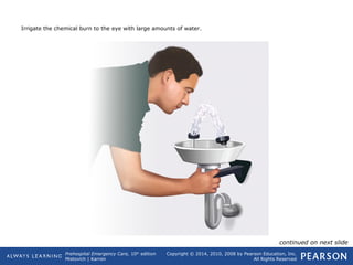 Prehospital Emergency Care, 10th
edition
Mistovich | Karren
Copyright © 2014, 2010, 2008 by Pearson Education, Inc.
All Rights Reserved
Irrigate the chemical burn to the eye with large amounts of water.
continued on next slide
 