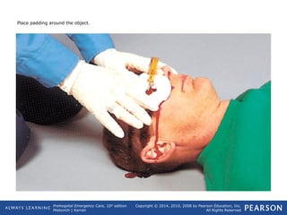 Prehospital Emergency Care, 10th
edition
Mistovich | Karren
Copyright © 2014, 2010, 2008 by Pearson Education, Inc.
All Rights Reserved
Place padding around the object.
 