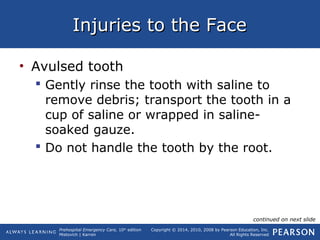 Prehospital Emergency Care, 10th
edition
Mistovich | Karren
Copyright © 2014, 2010, 2008 by Pearson Education, Inc.
All Rights Reserved
Injuries to the FaceInjuries to the Face
• Avulsed tooth
 Gently rinse the tooth with saline to
remove debris; transport the tooth in a
cup of saline or wrapped in saline-
soaked gauze.
 Do not handle the tooth by the root.
continued on next slide
 