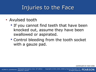 Prehospital Emergency Care, 10th
edition
Mistovich | Karren
Copyright © 2014, 2010, 2008 by Pearson Education, Inc.
All Rights Reserved
Injuries to the FaceInjuries to the Face
• Avulsed tooth
 If you cannot find teeth that have been
knocked out, assume they have been
swallowed or aspirated.
 Control bleeding from the tooth socket
with a gauze pad.
continued on next slide
 