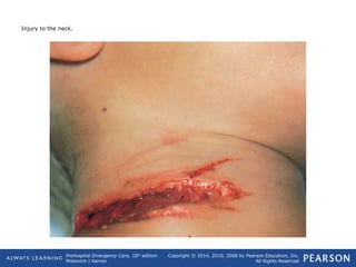 Prehospital Emergency Care, 10th
edition
Mistovich | Karren
Copyright © 2014, 2010, 2008 by Pearson Education, Inc.
All Rights Reserved
Injury to the neck.
 