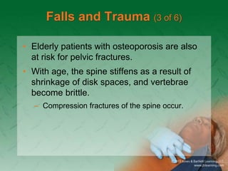 Falls and Trauma (3 of 6)
• Elderly patients with osteoporosis are also
at risk for pelvic fractures.
• With age, the spine stiffens as a result of
shrinkage of disk spaces, and vertebrae
become brittle.
– Compression fractures of the spine occur.
 