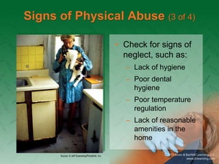 Signs of Physical Abuse (3 of 4)
• Check for signs of
neglect, such as:
– Lack of hygiene
– Poor dental
hygiene
– Poor temperature
regulation
– Lack of reasonable
amenities in the
home
Source: © Jeff Greenberg/PhotoEdit, Inc.
 