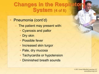 Changes in the Respiratory
System (4 of 8)
• Pneumonia (cont’d)
– The patient may present with:
• Cyanosis and pallor
• Dry skin
• Possible fever
• Increased skin turgor
• Pale, dry mucosa
• Tachycardia or hypotension
• Diminished breath sounds
 