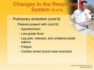Changes in the Respiratory
System (8 of 8)
• Pulmonary embolism (cont’d)
– Patients present with (cont’d):
• Apprehension
• Low-grade fever
• Leg pain, redness, and unilateral pedal
edema
• Fatigue
• Cardiac arrest (worst-case scenario)
 