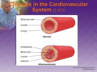 Changes in the Cardiovascular
System (3 of 5)
 