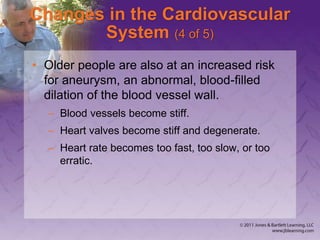 Changes in the Cardiovascular
System (4 of 5)
• Older people are also at an increased risk
for aneurysm, an abnormal, blood-filled
dilation of the blood vessel wall.
– Blood vessels become stiff.
– Heart valves become stiff and degenerate.
– Heart rate becomes too fast, too slow, or too
erratic.
 