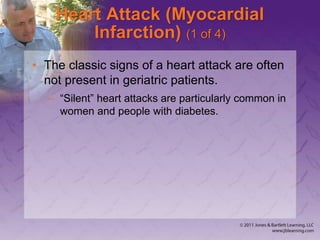 Heart Attack (Myocardial
Infarction) (1 of 4)
• The classic signs of a heart attack are often
not present in geriatric patients.
– “Silent” heart attacks are particularly common in
women and people with diabetes.
 